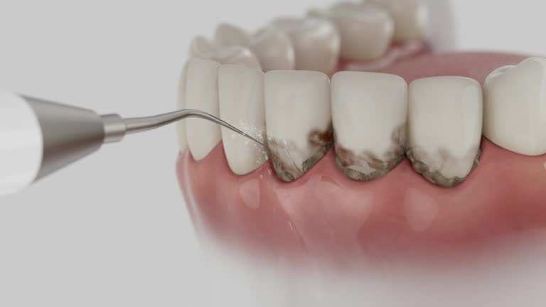 Trusted Dental Crowns And Bridges service in Hughesville, PA - Dentist Open Now